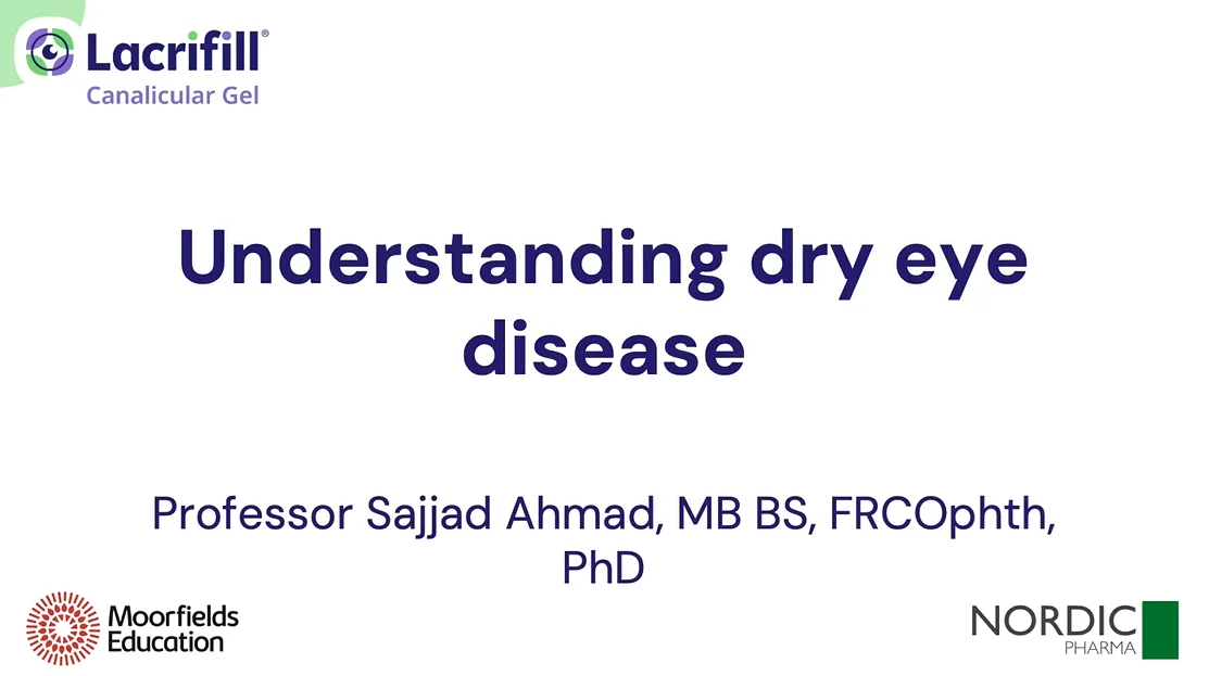 Understanding dry eye disease Understanding dry eye disease | Lacrifill